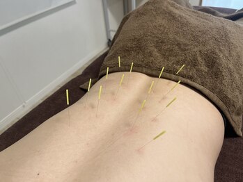 上楽スポーツ鍼灸院/腰痛・膝痛・怪我に効果◎