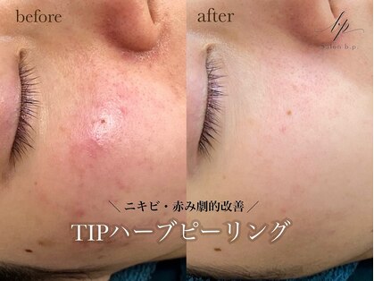 ビーピー 渋谷(b.p.)の写真