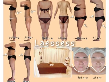 ラエッセス(A Laessess)の写真