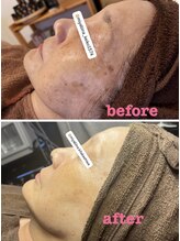 雅菜(miyabina)/70代シミケア細胞の生まれ変わり