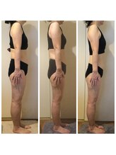 サロン ド ディジェール(Salon de Degel)/継続ケア4ヶ月目測定