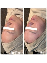 ディオーネ 春日井勝川店(Dione)/マーメイドセルトリートメント