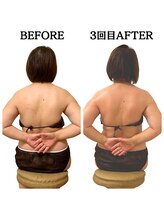 エミニー(EMINY)/