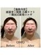 マルウル(maluulu)の写真/「小顔になりたい！」を叶える【頭蓋骨×頸椎 小顔リフト】小顔矯正と美容整体のいいとこどり♪