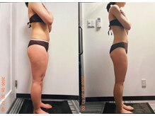 パーフェクトボディプレミアム 大阪梅田店(PERFECT BODY PREMIUM)/お客様　ビフォーアフター（27）