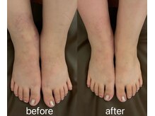 ヘレン(Helen)/ボディケア＊