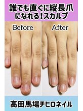 チヒロネイル/今すぐ縦長ネイルベットスカルプ