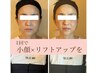 【小顔】1日3組限定！お試しコース！小顔骨格矯正¥9,000→¥2,980！