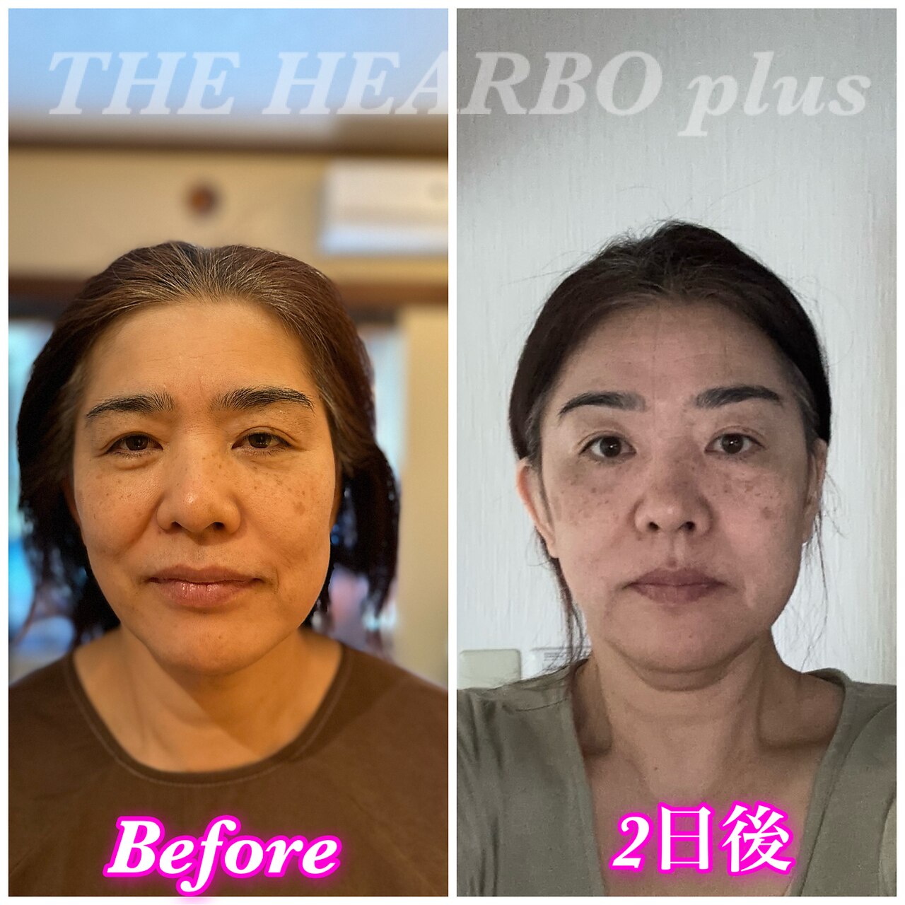 ハーボプラス(THE HEARBO plus)|ホットペッパービューティー ハーボプラス(THE HEARBO plus)|ホットペッパービューティー