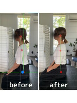 イトウ カイロプラクティックパートナー(ITOU)/Before &After
