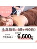 【レディース】全身つるすべ肌☆全身脱毛（顔・VIO込）¥15840→¥6,600