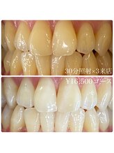 ホワイトニングルーム 川崎店(WhiteningRoom)/ホワイトニング/川崎　