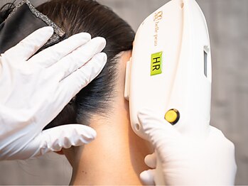 モアナ(MOANA)/うなじ脱毛