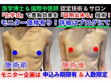 セブンシーズ 上野店(Seven Seas)の雰囲気（科学的根拠に基づいた技術開発☆葉月式豊胸エステ[バストケア]）