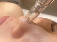 アム バイ オーキッド 代々木公園(UM by ORCHID)の雰囲気(【毛穴ケア】毛穴吸引+毛穴洗浄+毛穴引締めで黒ずみや開き解決◎)