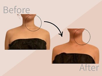 ファミーユ 名古屋店/【首肩、ブライダルケア】