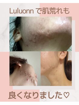 ヨサパーク モカ(YOSA PARK Moca)/お肌にも効果あります