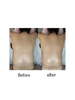 クリスタリオサーナエヌ 自由が丘(crystallo Sana N)/背中の痛みだけでなく見た目にも