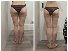 トータルビューティ リライフ(Total beauty Relife)