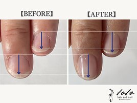 【toto式】自爪育成ネイルケア