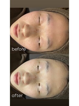 エクラ(ECLAT)/クールビタミンでくすみ改善！