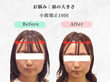 美容整体ウェリナ あま甚目寺院/小顔矯正/骨盤矯正/美脚サロン