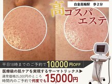 アモール(AMOR)