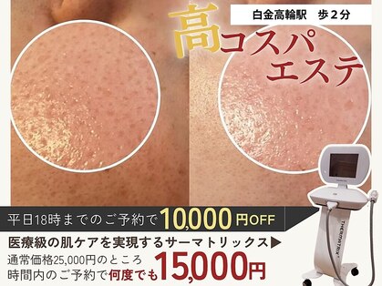 アモール(AMOR)の写真