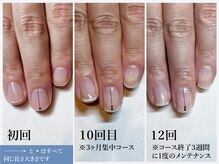 アルファ バイ ティース(ALPHA by tis30)/深爪でないけど爪が嫌い