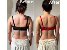 ラビス(RAVIS)/背中・二の腕スッキリ！！