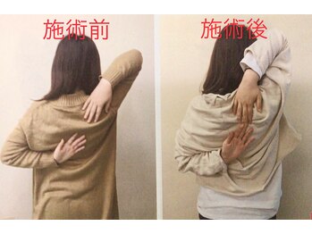 レガロ/施術前後での比較！