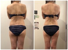 鈴木整体院 仙台泉院/小顔造顔/骨盤矯正/痩身整体