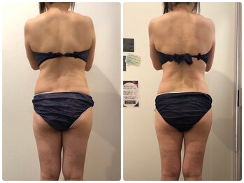 鈴木整体院 仙台泉院/小顔造顔/骨盤矯正/痩身整体