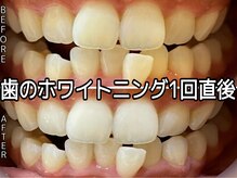 ヴィオール 名古屋栄店(VIOR)/他メニューとセットで特別価格♪