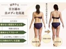 ヨサパーク シュエット(YOSA PARK CHOUETTE)