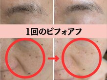 フローラ 品川(FLORA)の雰囲気（フォトギャラリーにビフォアフ多数掲載！「結果を出す」に注力）