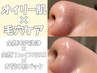 平日限定!毛も取れる毛穴洗浄【全顔ワックス脱毛+全顔毛穴洗浄】21800→9900