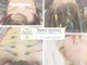 ベッラドンナ(Bella donna)の写真/完全個室で鍼灸体験♪鍼灸で美と健康をサポート！お肌のお悩みに美容鍼、お身体・頭髪のお悩みに鍼灸施術
