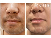 ハイドア(high door)