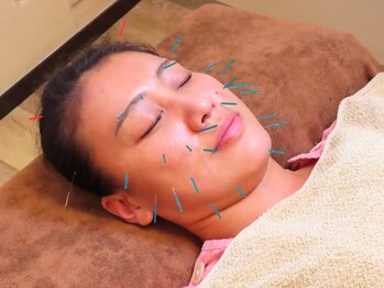 ヒーリングゆう/美容鍼