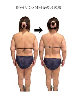 エスエー(SA)/Before/after