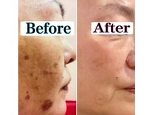 トータルビューティーサロン 凛の雰囲気（【たるみ×くすみWケア】年齢肌の引き締め◎　シミ、二重あご◎）