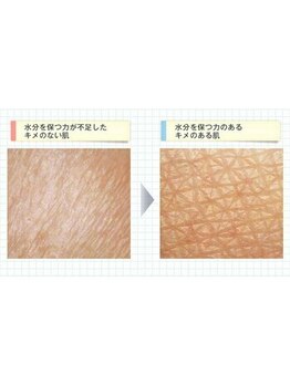 ゴールデンケア 岡崎店(Golden Care)/シミ・毛穴洗浄・フェイシャル