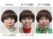 リーシャ(Reesha)/ダイヤモンドピールプログラム