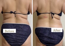 ヨサパーク シュエット(YOSA PARK CHOUETTE)