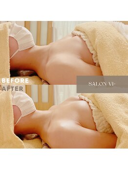 サロン ヴィプラス(SALON Vi+)/初回バストケアのBeforeAfter