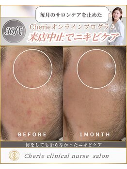 シェリー(Cherie)/皮膚の乾燥・キメ改善！透明感UP