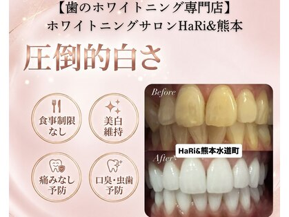 ハリト 熊本 上通り水道町(HaRi&)の写真