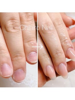 チヒロネイル/ダブルフェイク自爪スカルプ
