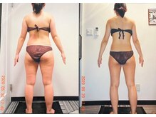 パーフェクトボディプレミアム 大阪梅田店(PERFECT BODY PREMIUM)/お客様　ビフォーアフター（27）